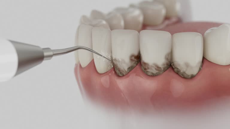 Reliable Dental Implants contractor in Ouachita County County, AR by Dentist Open Now